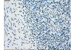 Immunohistochemistry (IHC) image for anti-Budding Uninhibited By Benzimidazoles 1 Homolog beta (Yeast) (BUB1B) antibody (ABIN1496996) (BUB1B anticorps)