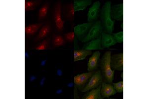 ABIN6261879 and ABIN6277946 staining  cells by IF/ICC.