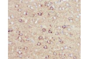 IHC-P: Amyloid beta antibody testing of mouse brain tissue (APP anticorps  (C-Term))