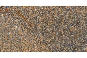 Immunohistochemistry of paraffin-embedded Human tonsil tissue using CPA2 Polyclonal Antibody at dilution 1:40