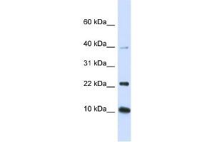 UBE2D2 antibody used at 1 ug/ml to detect target protein. (UBE2D2 anticorps)