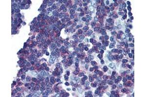 Immunohistochemical staining (Formalin-fixed paraffin-embedded sections) of human thymus with LAT monoclonal antibody, clone LAT1111  at 10 ug/mL working concentration. (LAT anticorps  (Cytoplasmic Domain))