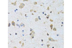 Immunohistochemistry of paraffin-embedded Rat brain using PDP1 Polyclonal Antibody at dilution of 1:100 (40x lens). (PDP anticorps)