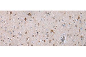Immunohistochemistry of paraffin-embedded Human brain tissue using COX7C Polyclonal Antibody at dilution of 1:40(x200) (COX7C anticorps)