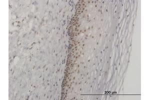 Immunoperoxidase of monoclonal antibody to FOXL1 on formalin-fixed paraffin-embedded human uterine cervix.