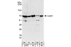 Western Blotting (WB) image for anti-CDKN2A Interacting Protein (CDKN2AIP) (AA 1-50) antibody (ABIN7449689)