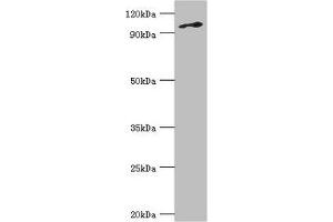 Western blot All lanes: DNA replication licensing factor MCM6 antibody at 3 μg/mL + Jurkat whole cell lysate Secondary Goat polyclonal to rabbit IgG at 1/10000 dilution Predicted band size: 93 kDa Observed band size: 93 kDa (MCM6 anticorps  (AA 562-821))