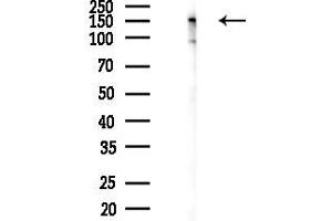 Western blot analysis of lysates from F10-LUC cells(heat-shock 45 min treatment), using IGF1R/Insulin Receptor Antibody at 1/1000 dilution.