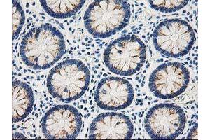 Immunohistochemical staining of paraffin-embedded Human colon tissue using anti-AK4 mouse monoclonal antibody. (AK4 anticorps)