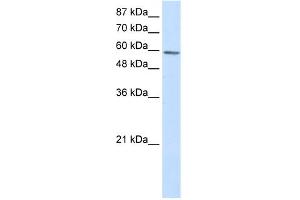 WB Suggested Anti-TP73 Antibody Titration:  2. (Tumor Protein p73 anticorps  (N-Term))