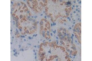 Used in DAB staining on fromalin fixed paraffin- embedded kidney tissue (ACP6 anticorps  (AA 1-428))