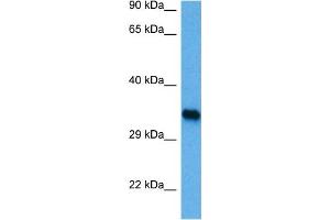 Host:  Rabbit  Target Name:  IRF1  Sample Tissue:  Mouse Brain  Antibody Dilution:  1ug/ml