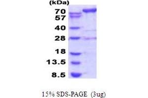 SDS-PAGE (SDS) image for Adenosine Monophosphate Deaminase 2 (AMPD2) (AA 236-879) protein (His tag) (ABIN6387507)