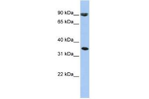 WB Suggested Anti-SLC10A7 Antibody Titration:  0. (SLC10A7 anticorps  (Middle Region))
