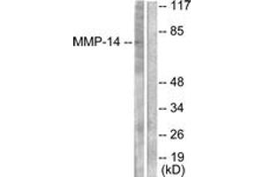 Western blot analysis of extracts from NIH-3T3 cells, using MMP-14 Antibody. (MMP14 anticorps  (AA 471-520))