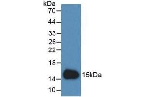 Detection of Recombinant Cys-c, Human using Monoclonal Antibody to Cystatin C (Cys-C) (Cystathionine-gamma-Synthase Precursor (CYS) (AA 27-146) anticorps)