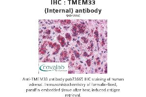 Image no. 1 for anti-Transmembrane Protein 33 (TMEM33) (Internal Region) antibody (ABIN1740155) (TMEM33 anticorps  (Internal Region))