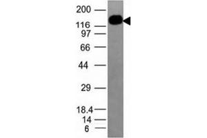 Western blot analysis of HL-60 cell lysate using ICAM3 antibody (ICAM3/1019). (ICAM-3/CD50 anticorps)