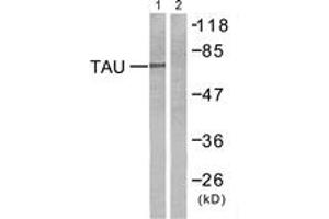 Western blot analysis of extracts from mouse brain cells, using Tau (Ab-212) Antibody. (tau anticorps  (AA 496-545))