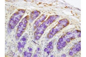 Formalin-fixed and paraffin embedded rat colon labeled with Rabbit Anti-DR4 Polyclonal Antibody, Unconjugated  at 1:200 followed by conjugation to the secondary antibody and DAB staining