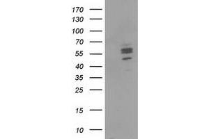 Image no. 1 for anti-Carnosine Dipeptidase 1 (Metallopeptidase M20 Family) (CNDP1) antibody (ABIN1497547) (CNDP1 anticorps)