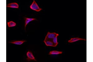 ABIN6261368 and ABIN6273232 staining Hela by IF/ICC. (DBN1 anticorps  (Internal Region))