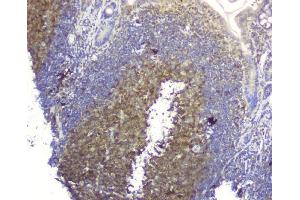 IHC analysis of SQSTM1 using anti-SQSTM1 antibody (ABIN3043937). (SQSTM1 anticorps  (N-Term))