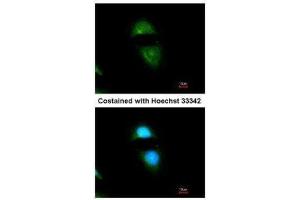 ICC/IF Image Immunofluorescence analysis of methanol-fixed HeLa, using Cytochrome P450 Reductase, antibody at 1:200 dilution.