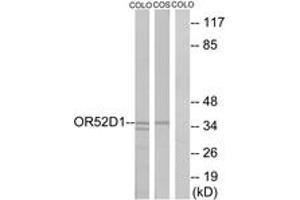 Western Blotting (WB) image for anti-Olfactory Receptor, Family 52, Subfamily D, Member 1 (OR52D1) (AA 269-318) antibody (ABIN2890937) (OR52D1 anticorps  (AA 269-318))
