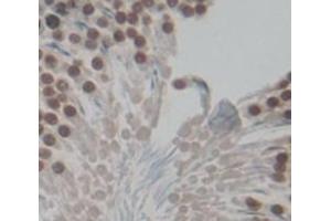 IHC-P analysis of Kidney tissue, with DAB staining. (FOXM1 anticorps  (AA 209-460))