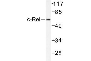 Image no. 1 for anti-REL proto-oncogene (c-Rel) antibody (ABIN271805) (c-Rel anticorps)