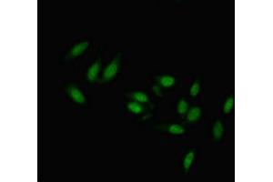 Immunofluorescent analysis of Hela cells using ABIN7173229 at dilution of 1:100 and Alexa Fluor 488-congugated AffiniPure Goat Anti-Rabbit IgG(H+L)