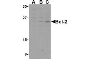 Western blot analysis of Bcl-2 in A-20 cell lysates with AP30129PU-N Bcl-2 antibody at (A) 1, (B) 2, and (C) 4 μg/ml. (Bcl-2 anticorps  (Intermediate Domain))