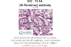 Image no. 1 for anti-Tumor Necrosis Factor (Ligand) Superfamily, Member 15 (TNFSF15) antibody (ABIN1740101) (TNFSF15 anticorps)