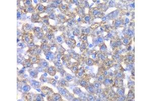 Immunohistochemistry of paraffin-embedded Mouse liver using CCBL1 Polyclonal Antibody at dilution of 1:100 (40x lens). (CCBL1 anticorps)