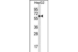 TBC1D22A Antibody (C-term) (ABIN656780 and ABIN2845998) western blot analysis in HepG2 cell line lysates (35 μg/lane). (TBC1D22A anticorps  (C-Term))