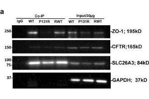 Identification of SLC26A3 as a CFTR and ZO-1 binding partner and effects on their interaction.