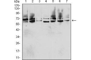 Western blot analysis using IGF2BP3 mouse mAb against Hela (1), Jurkat (2), NIH/3T3 (3), COS7 (4), HepG2 (5), K562 (6) and A549 (7) cell lysate.
