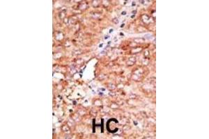 Immunohistochemistry (IHC) image for anti-Chemokine Binding Protein 2 (CCBP2) antibody (ABIN3001324) (CCBP2 anticorps)
