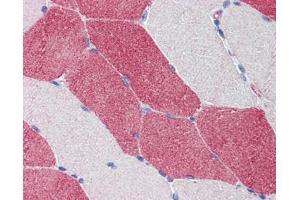 HMGCS1 antibody was used for immunohistochemistry at a concentration of 4-8 ug/ml.