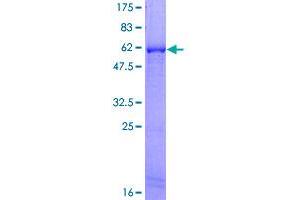 SDS-PAGE (SDS) image for Hydroxyacyl-CoA Dehydrogenase (HADH) (AA 1-314) protein (GST tag) (ABIN1306320)