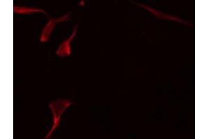 ABIN6274226 staining HepG2 by IF/ICC.