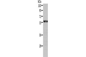Western Blotting (WB) image for anti-Aldehyde Dehydrogenase 6 Family, Member A1 (ALDH6A1) antibody (ABIN2422525) (ALDH6A1 anticorps)