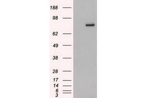 Western Blotting (WB) image for anti-Signal Transducer and Activator of Transcription 4 (STAT4) (AA 633-652) antibody (ABIN1491621)
