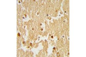 Formalin-fixed and paraffin-embedded human brain tissue reacted with ESRRB Antibody , which was peroxidase-conjugated to the secondary antibody, followed by DAB staining. (ESRRB anticorps  (Middle Region))