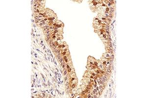 Immunohistochemical analysis of paraffin-embedded H. (IDH1 anticorps  (AA 116-143))