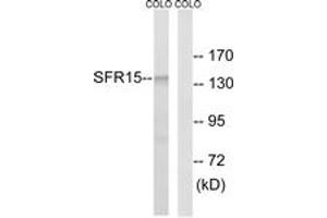 Western blot analysis of extracts from COLO cells, using SFRS15 Antibody. (SCAF4 anticorps  (AA 601-650))
