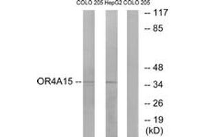 Western Blotting (WB) image for anti-Olfactory Receptor, Family 4, Subfamily A, Member 15 (OR4A15) (AA 261-310) antibody (ABIN2890996) (OR4A15 anticorps  (AA 261-310))
