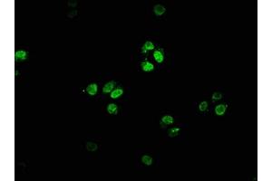 Immunofluorescence staining of HepG2 cells with ABIN7153076 at 1:66, counter-stained with DAPI. (FOXN4 anticorps  (AA 89-194))
