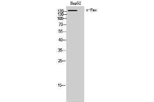 Western Blotting (WB) image for anti-Colony Stimulating Factor 1 Receptor (CSF1R) (Ser275) antibody (ABIN6284703)